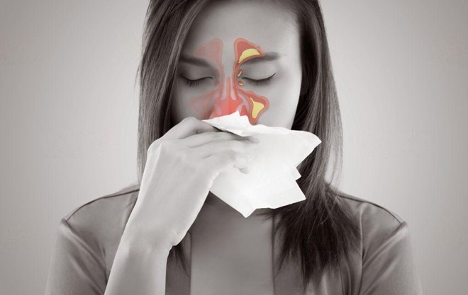 Consult Singapore ENT doctor on sinus problems